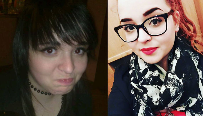 Me In My Emo Phase, And Now 7 Years Later. I Would Have Never Tought That I Would Become A Person I Am Today. Now I Listen To Pop Music And I'm Pretty Much A Social Butterfly.