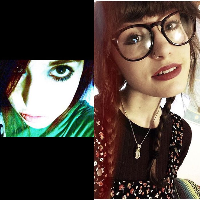 14 Vs. 20...a Lot Has Changed, Including The Fact That I Now Have A Nose!