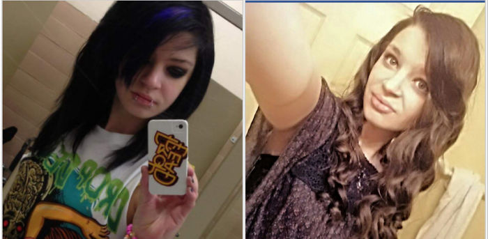 2012 And 2017. I Am Now A Mother Of A 2 Year Old And Acna. Crazy How Life Changes.