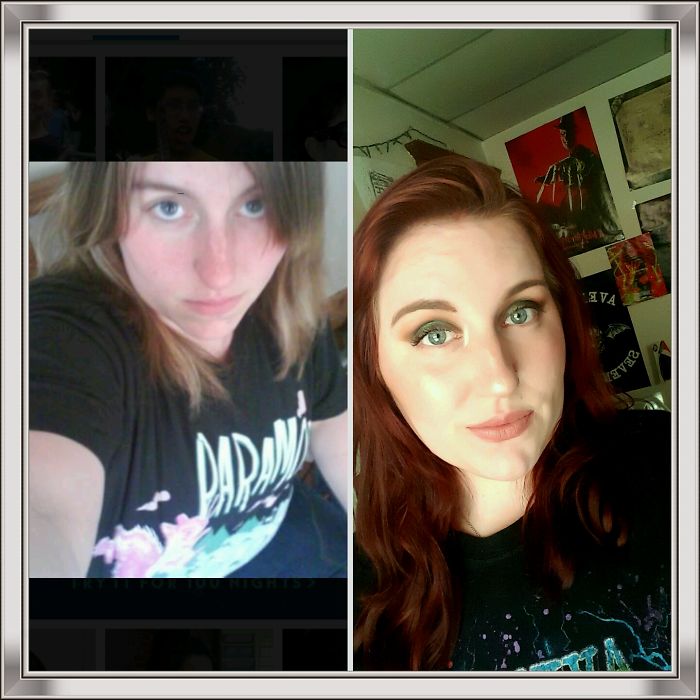 2010 To 2017, I Clearly Thought I Was Super Edgy And Emo, Now I'm Loving Life And Don't Have A Care In The World