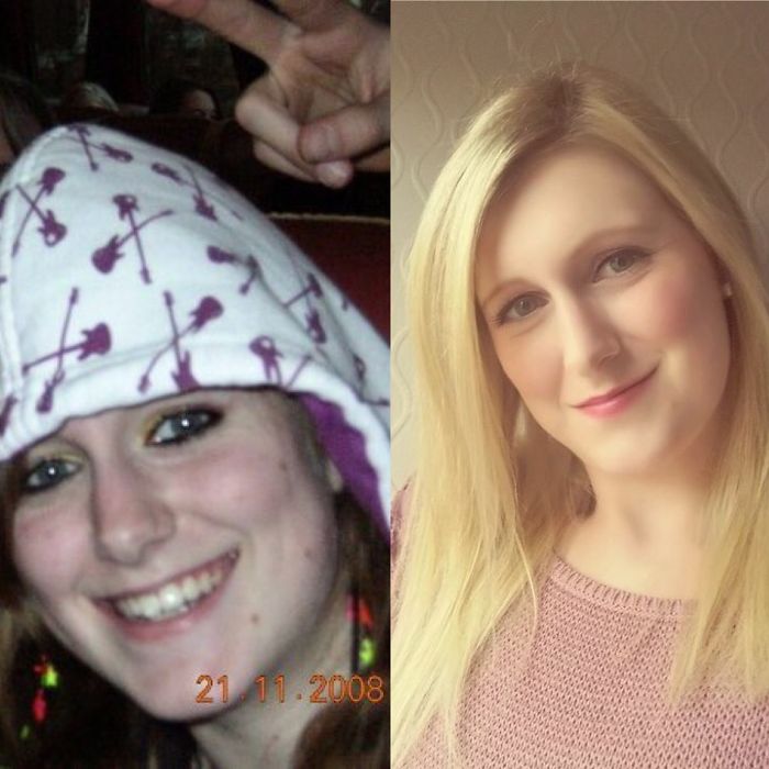 Me At 16 Years Old And Into Emo And Metal And Nog 25 A Logistic Manager And Proud Owner Of Diploma And Cat