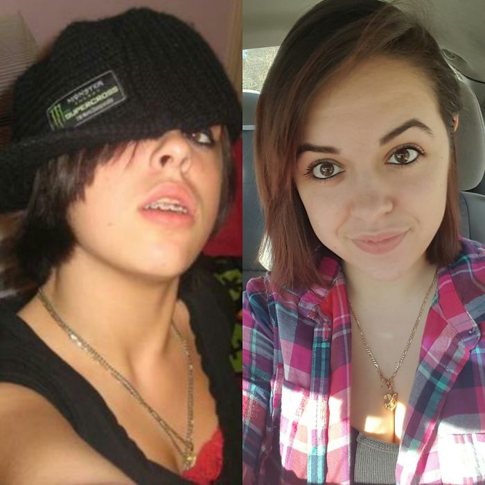 How I Looked In My "emo Phase" Vs How I Look Now