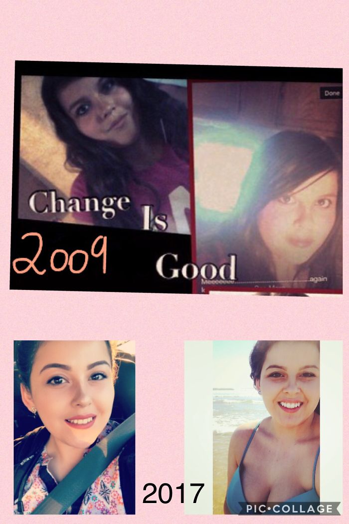 Lol God Is Good. Elmo Phase In 7th Grade(unsure If It Was 2009).now In Finishing Up School To Become A Registerd Dental Assistant. Wth Was I Thinking Lmbo ....anyways Emo Kids Reading These ...it Gets Better:)