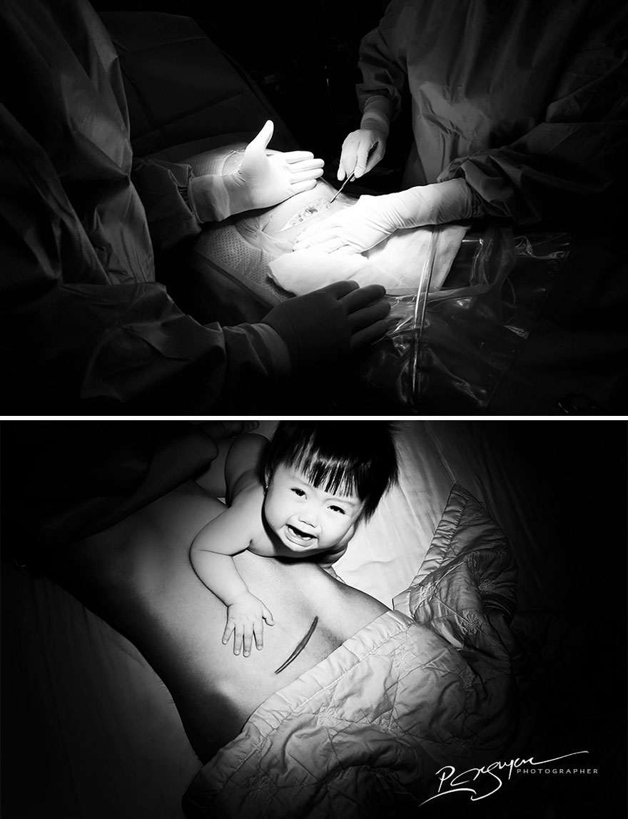 Scars Are A Phobia For Women. As Soon As The Baby Sees Them, She Is Frightened And Starts Crying