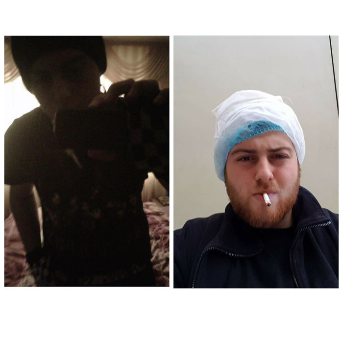 Well Me At 16 Vs Me At 22 , Seems Life Change Everyone Even Me :) . It Was Really Good Times Back Then ( Weed,music And Chill )