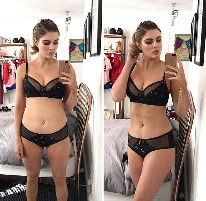 Side-by-side comparison of good posture versus bad posture in a woman wearing black lingerie, highlighting body alignment changes.