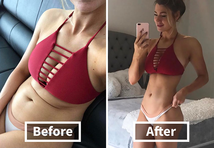 32 Nude Before-and-After Photos – Good Posture Vs. Bad Posture