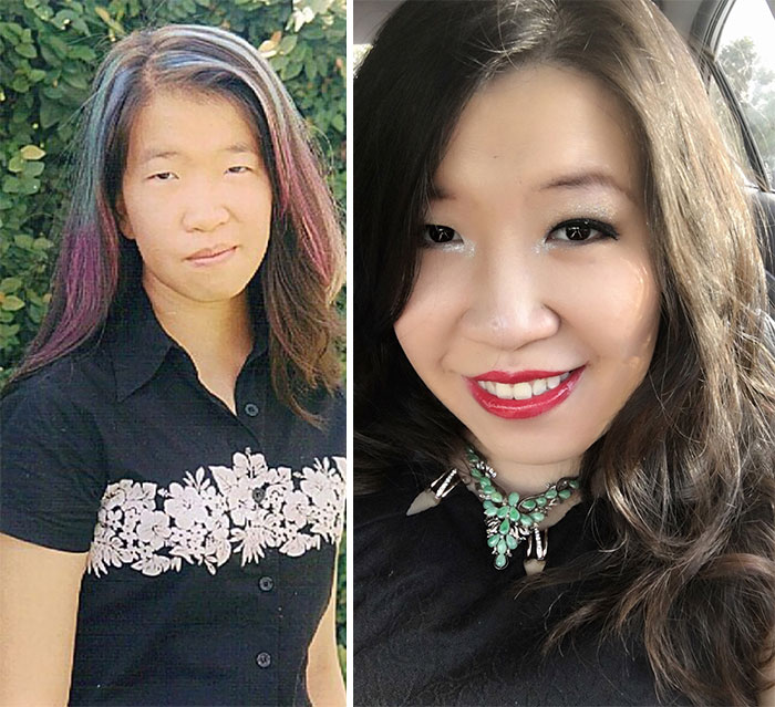 At The Age 14 I Had Ombré Hair Before The Hipsters. Now I'm 28 - Married For Almost 2 Years And Expecting A Baby. Been Working As A Dentist For 5 Years Now! I Hate My Fashion Sense As A Kid