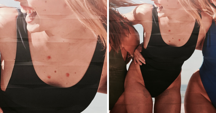 We Stuck Pimples On Billboards To Make Ads More Realistic