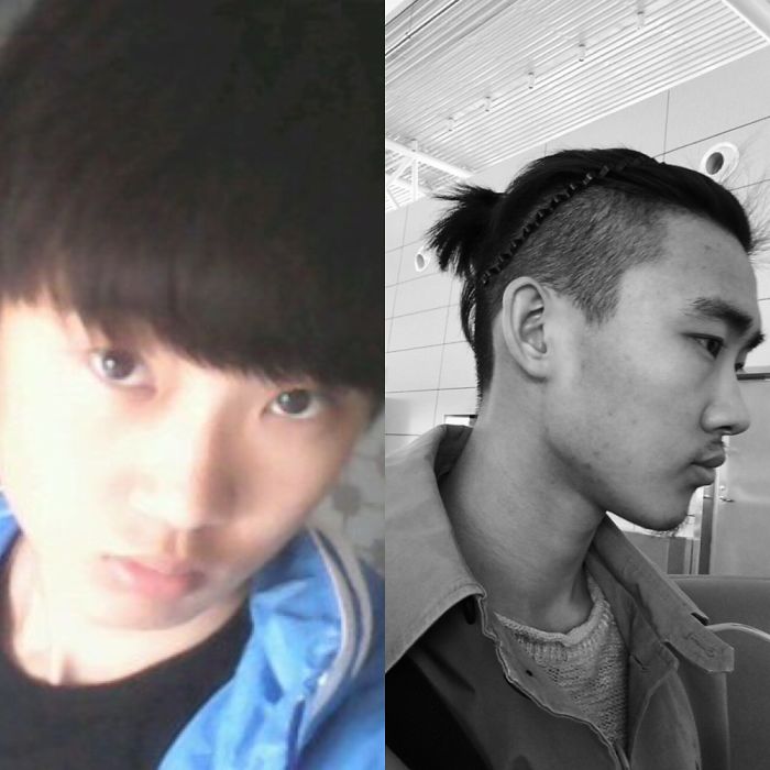 Before/after 10 Years