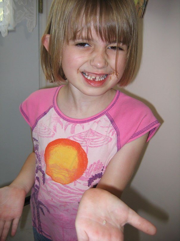 Detoothed For The First Time