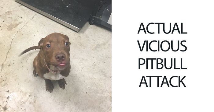 21-Year-Old Inspires People To Share Photos Of “Vicious Pit Bull Attacks”, And It’s Just Too ‘Scary’