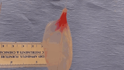 Scientists Transform Spinach Leaves Into Working Human Heart Tissue Scientists Transform Spinach Leaves Into Working Human Heart Tissue