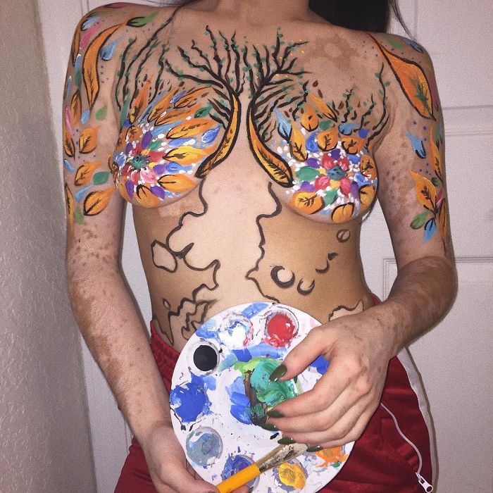 After Being Bullied For Vitiligo All Her Life, This Girl Now Turns Her Body Into Amazing Art After Being Bullied For Vitiligo All Her Life, This Girl Now Turns Her Body Into Amazing Art