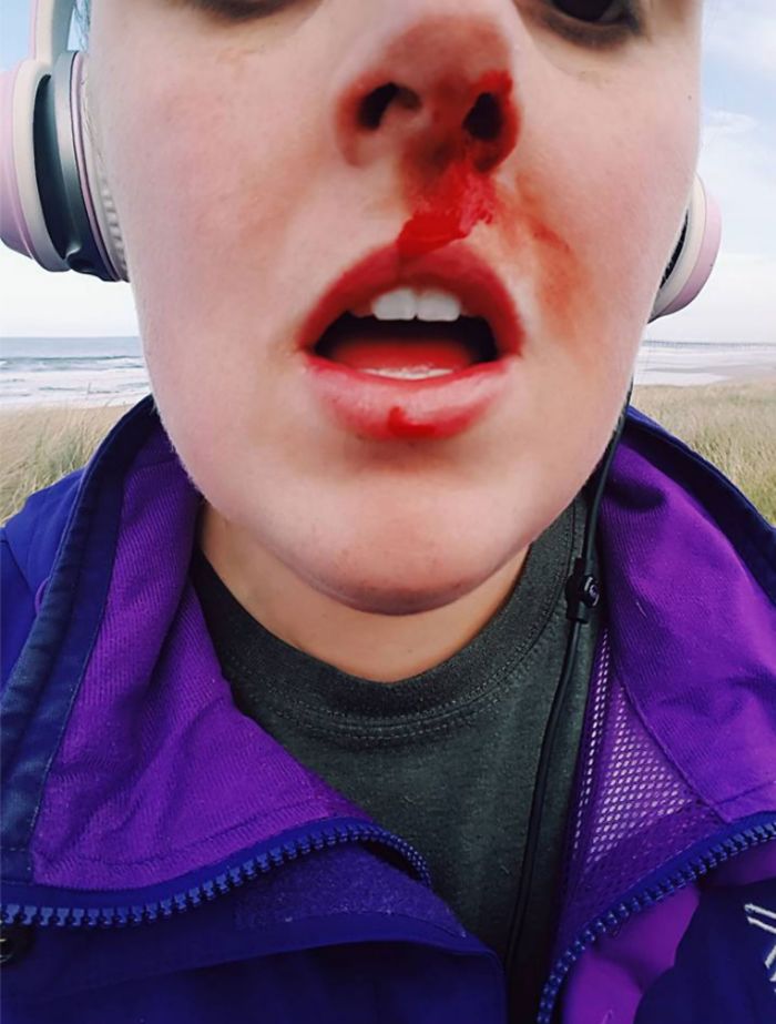 Woman Confronts Teenagers Torturing A Baby Seal, Gets Punched In The Face Woman Confronts Teenagers Torturing A Baby Seal, Gets Punched In The Face