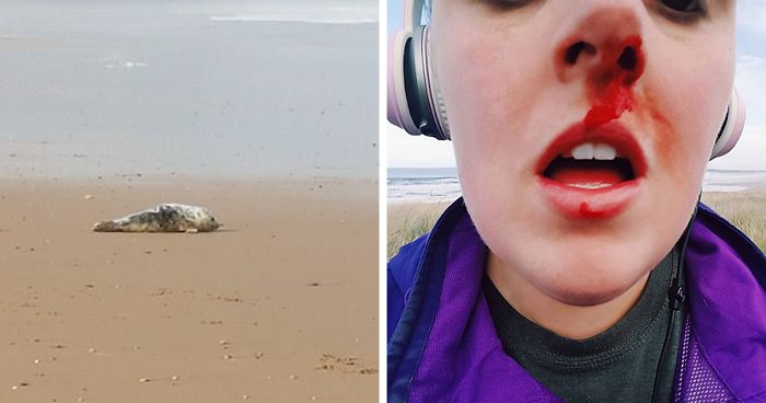 Woman Confronts Teenagers Torturing A Baby Seal, Gets Punched In The Face