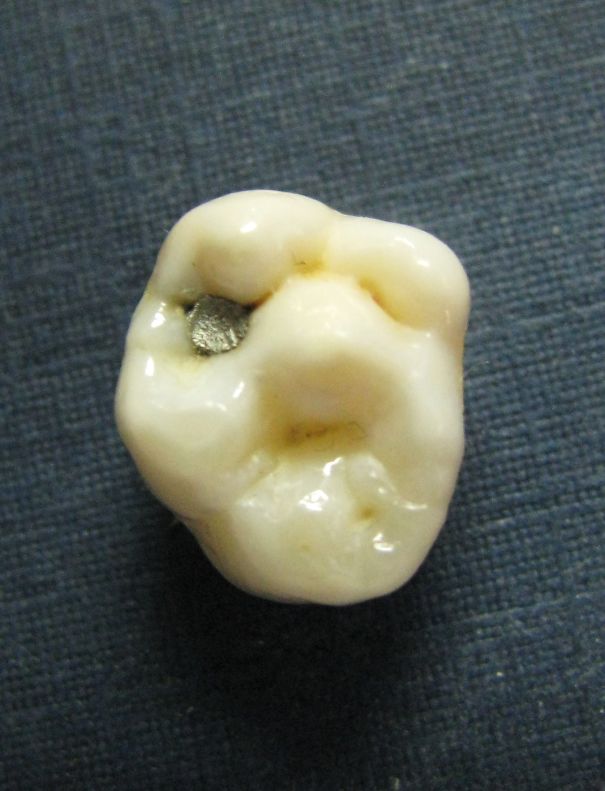 The Old Man In The Tooth