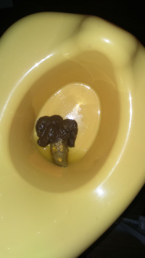 My Son Pooped Sideshow Bob