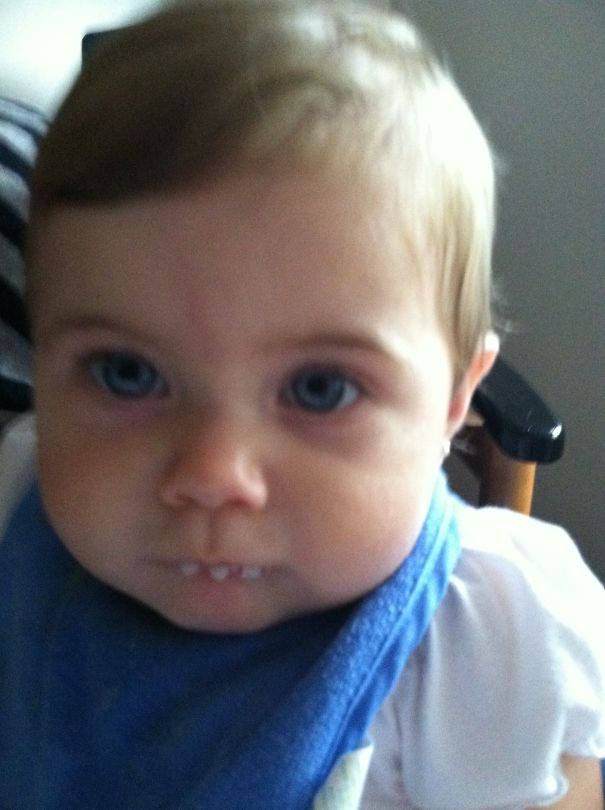 Mashed Potatoes From Fork Look Like Teeth