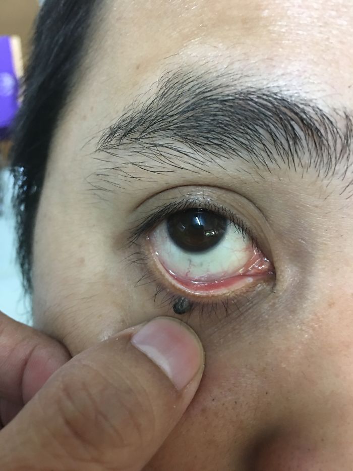 Chinky Eyes.... Please Step Out Of United Airlines...