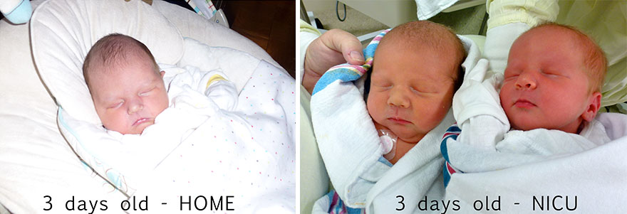 Side By Side Comparison Of My Singleton Pregnancy And My Twin Pregnancy