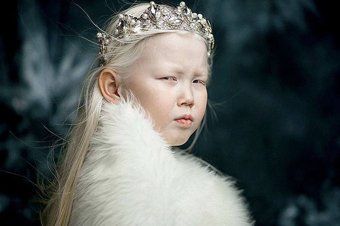 albino-girl-snow-white-nariyana-siberia-14 albino-girl-snow-white-nariyana-siberia-14
