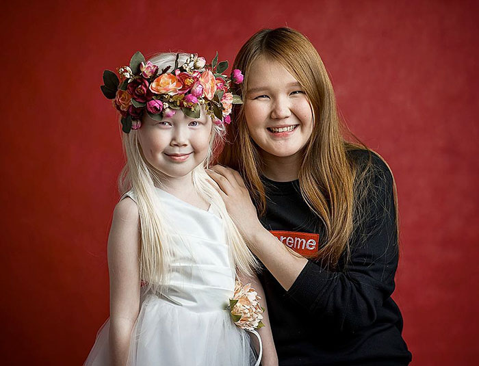 albino-girl-snow-white-nariyana-siberia-19 albino-girl-snow-white-nariyana-siberia-19