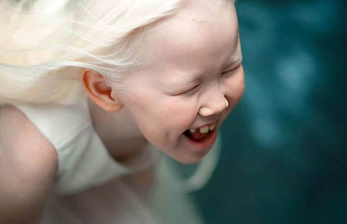 albino-girl-snow-white-nariyana-siberia-2 albino-girl-snow-white-nariyana-siberia-2