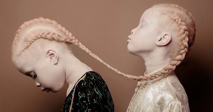 Albino Twins From Brazil Are Taking The Fashion Industry By Storm With Their Unique Beauty