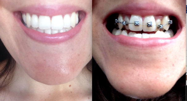 All The Pain Was Worth It!