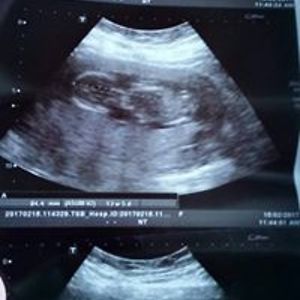 steveabbiemackey avatar