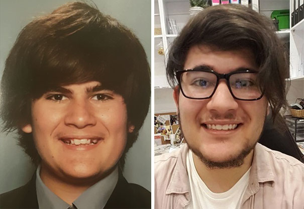 After Almost 3 Years Of Teeth Work I'm Free Of Braces