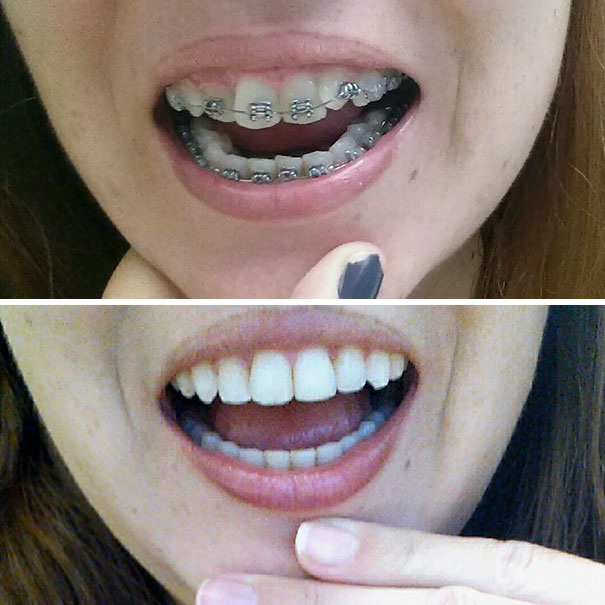 $3000 And Ten Months Later