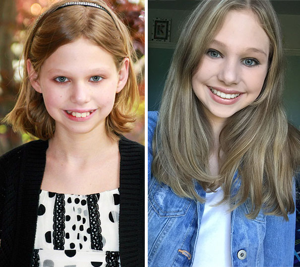 I Would Like To Thanks Braces And Puberty For This Transformation