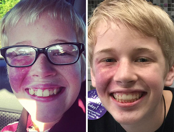 Holy Wow, What A Difference!