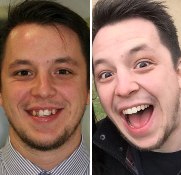 Amazing Transformation