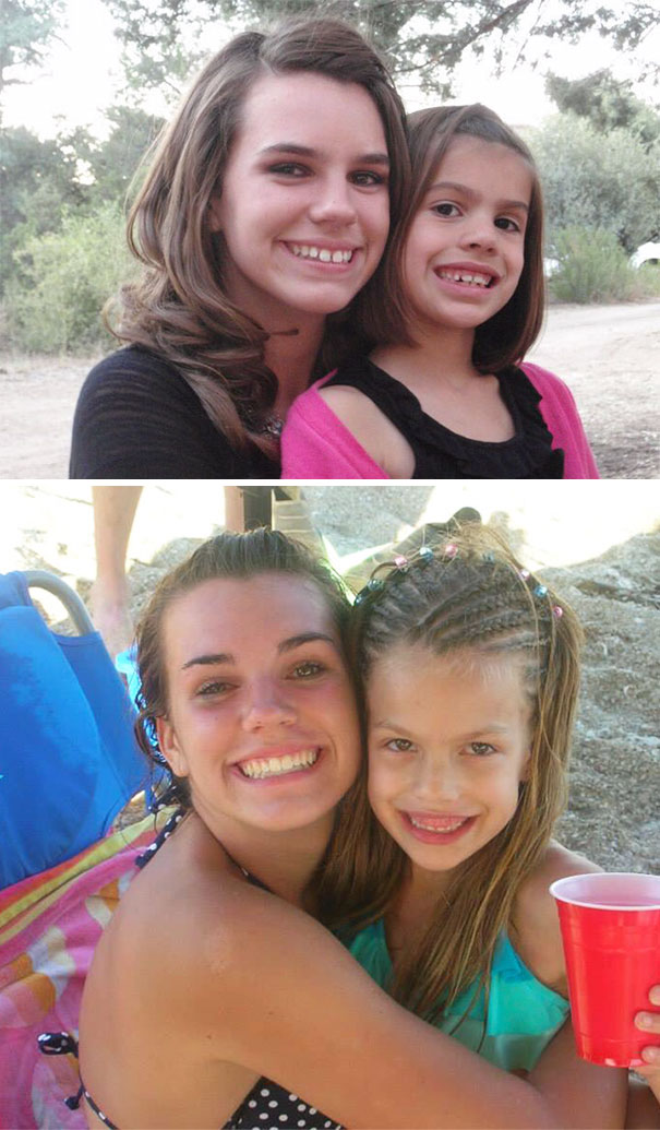 Imma Thank God For Braces