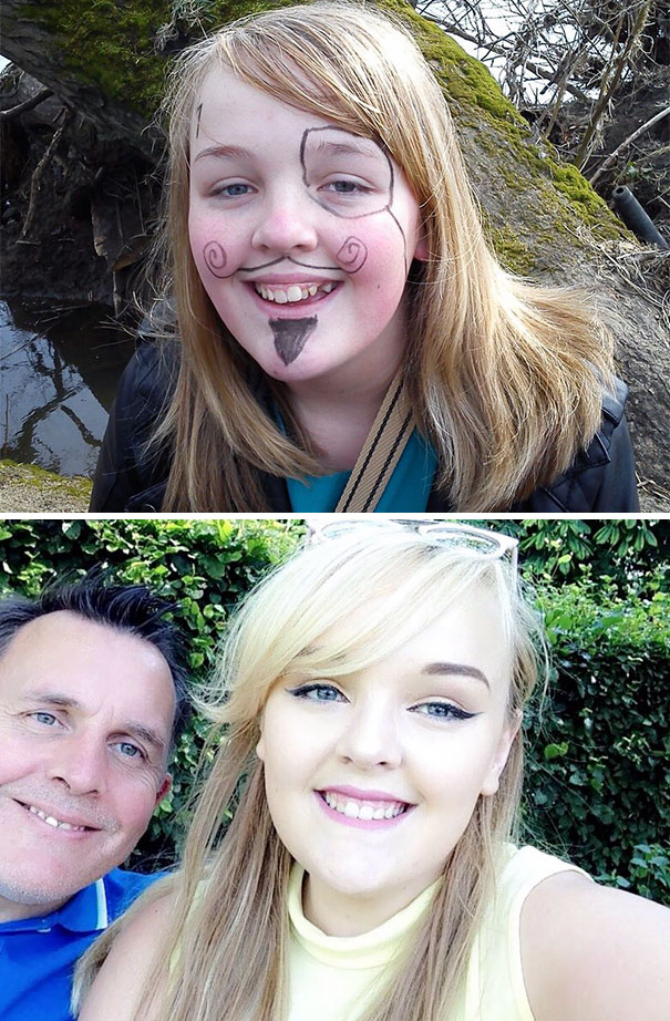 Thank The Lord For Someone Making Me Wear Braces For 6 Years