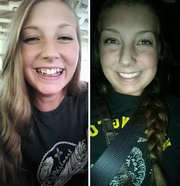 I Would Like To Get A Special Shout Out To Braces, Thank You For Everything You've Done For Me I Appreciate It