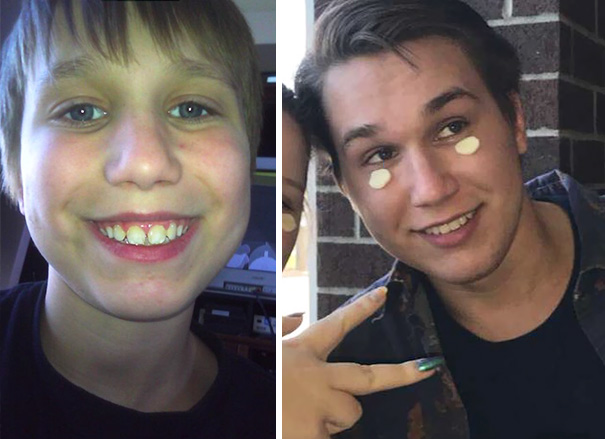 Thank God For Braces