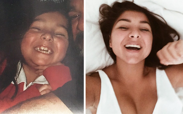 Thank God For Braces