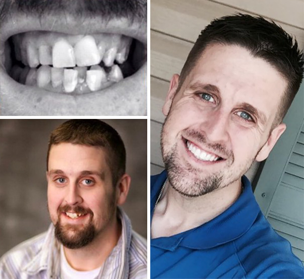 Amazing Smile Transformation!