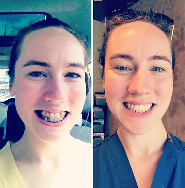 Thanks For My Beautiful Smile