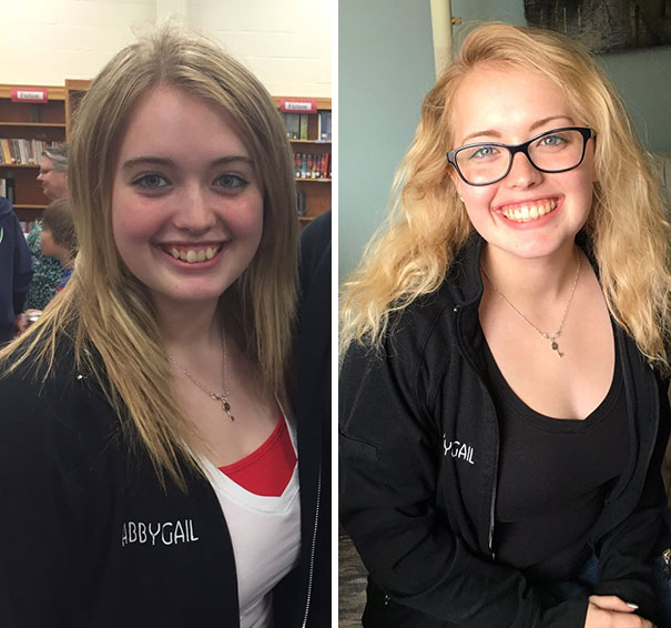 The Amount Of Confidence I Received After I Got My Braces Taken Off Is Remarkable. I Am Proud To Show Off My Smile