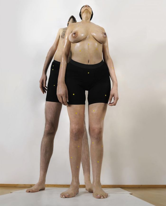 Human Dilatations