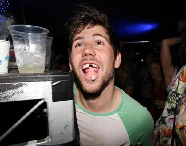 Night-Club Guy Losing A Tooth