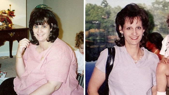 This Is When I Weighed The Most – About 305 Pounds And After I Lost 150 Pounds