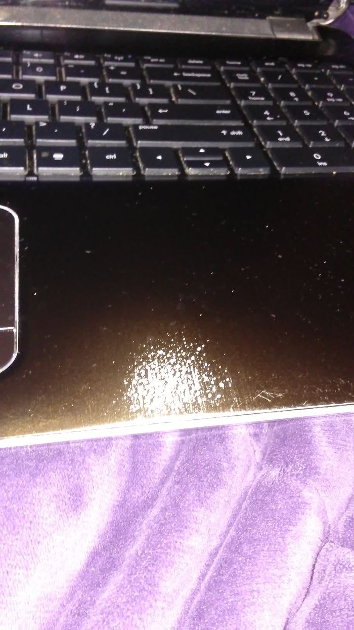 My Laptop Is 6 Years Old And Shows That I Use My Mouse A Lot.