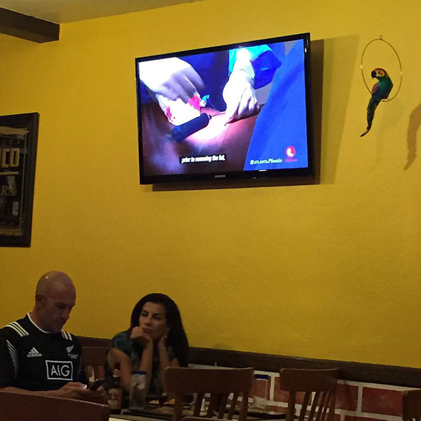 Ah Yes. Nothing Gets Me More In The Mood To Eat Mexican Food Than Watching Someone Get Liposuction On The Big Screen