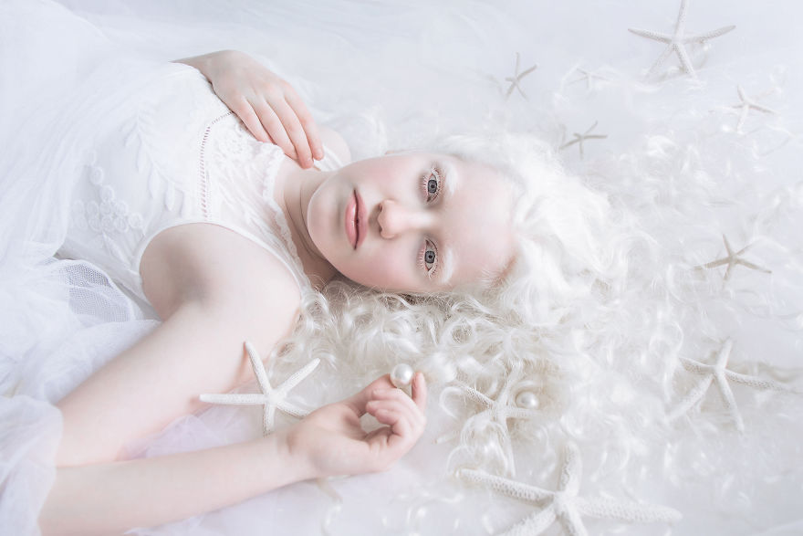 I Captured The Hypnotizing Beauty Of Albino People (Part 2) I Captured The Hypnotizing Beauty Of Albino People (Part 2)